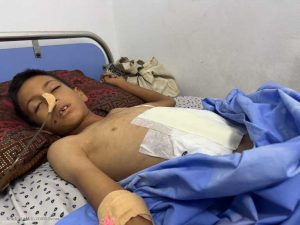 bambino ricoverato. Foto scattata durante la visita dell'UNICEF all'ospedale di Al Helou e al Patient-Friendly Hospital di Gaza City, il 15 luglio 2025. Infinite realtà.it